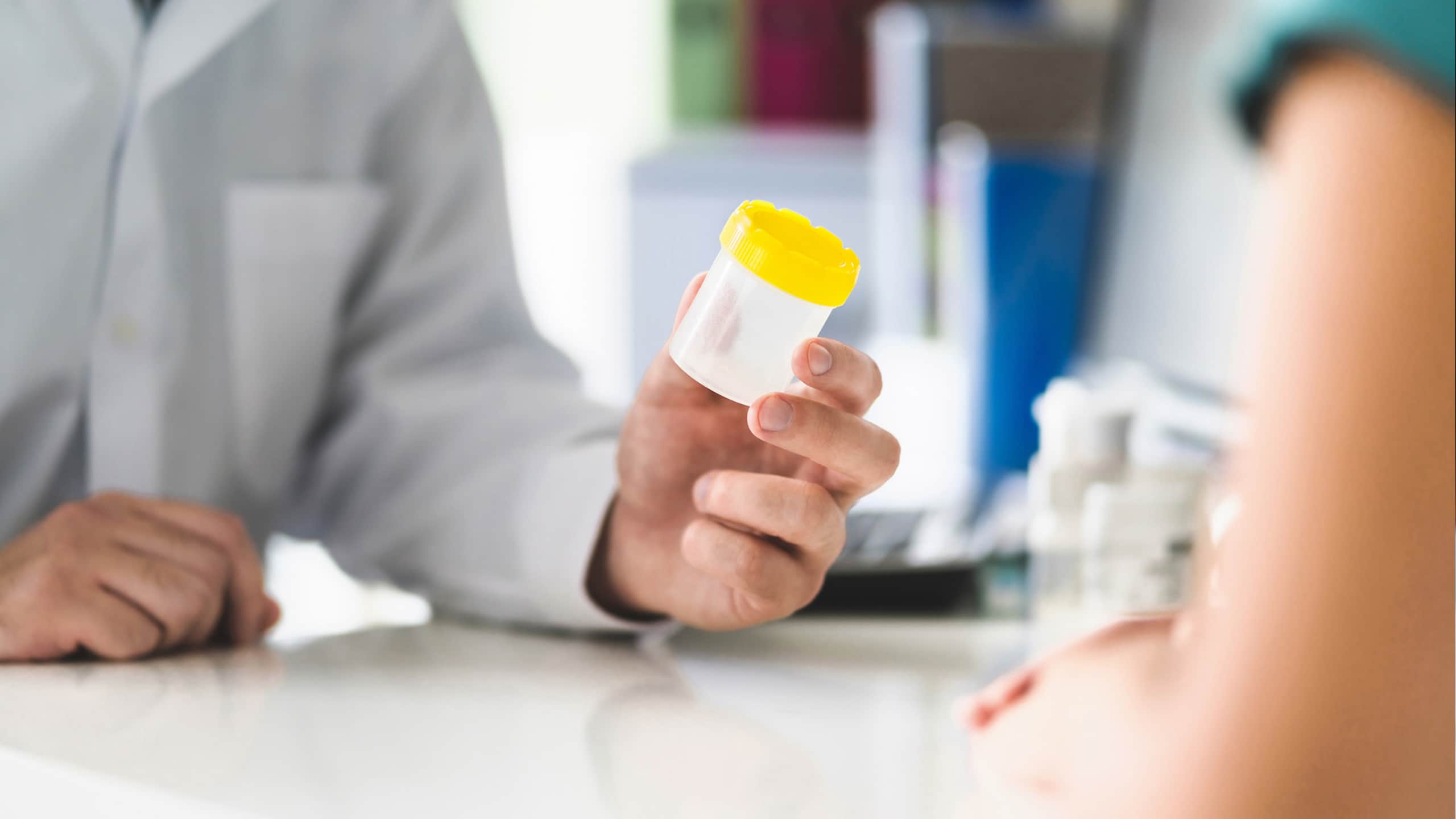 Sexually transmitted infections (STIs)