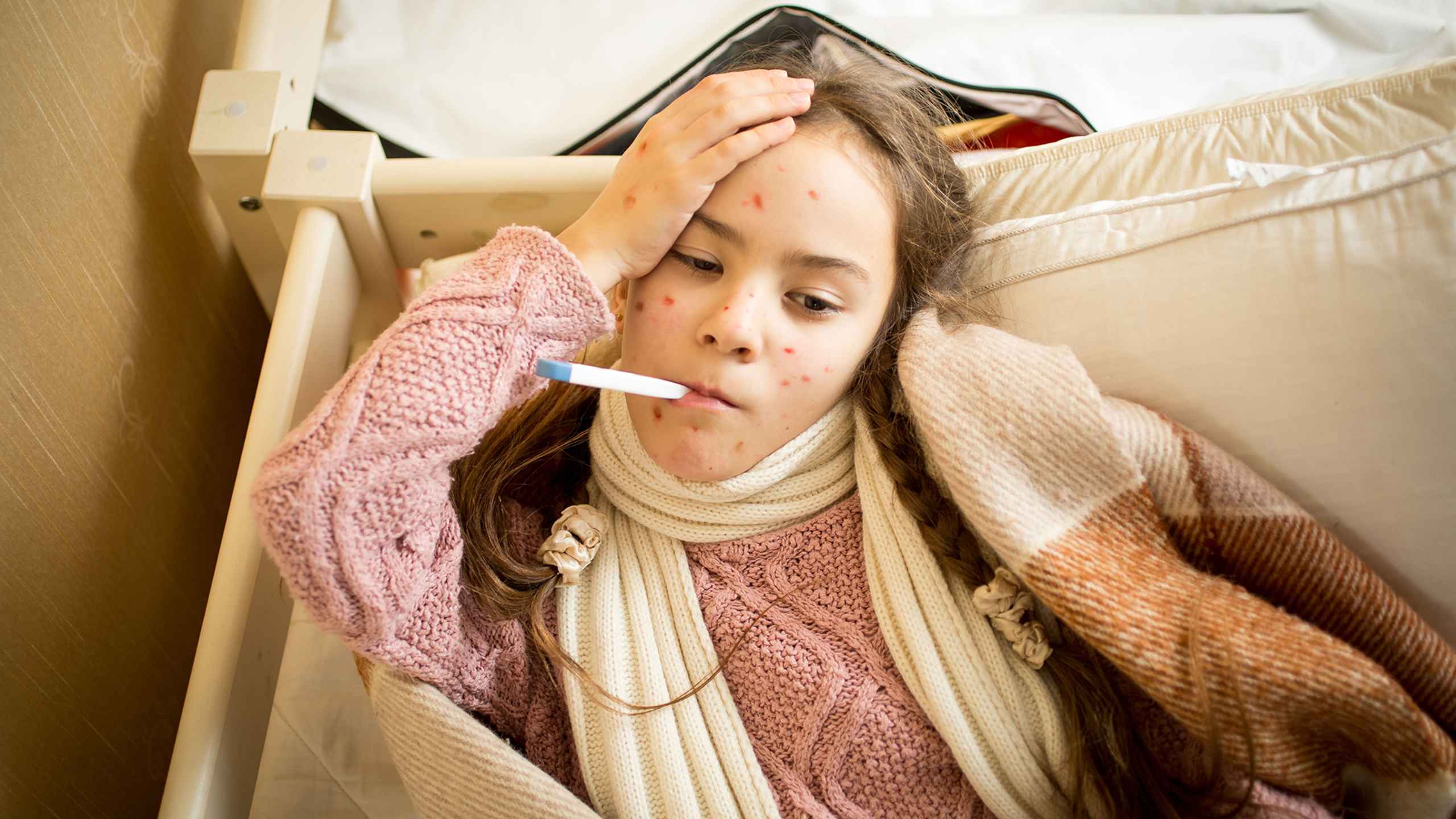 Is Shingles the same as Chickenpox?