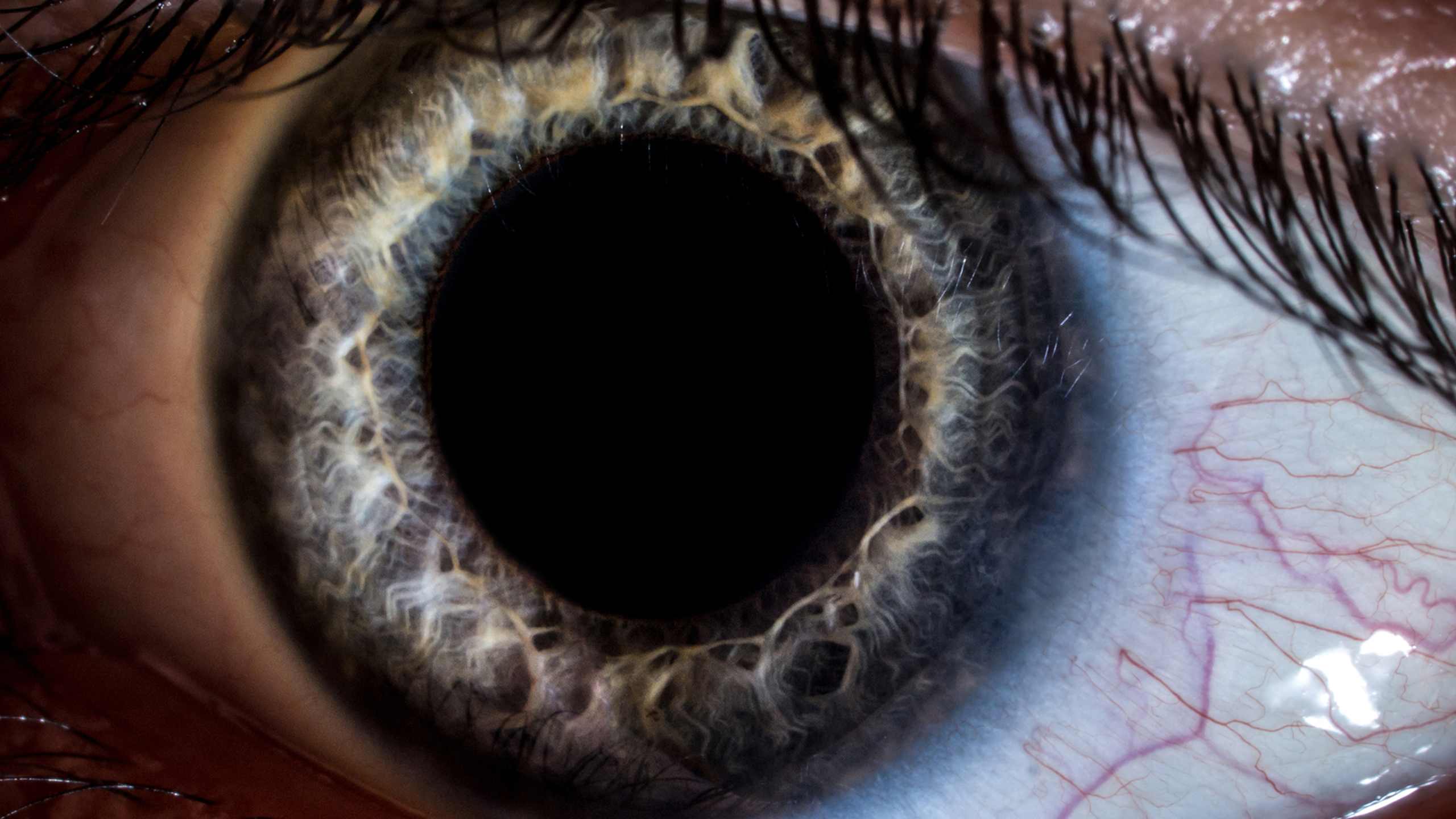 Eyes can reveal neurological disorders