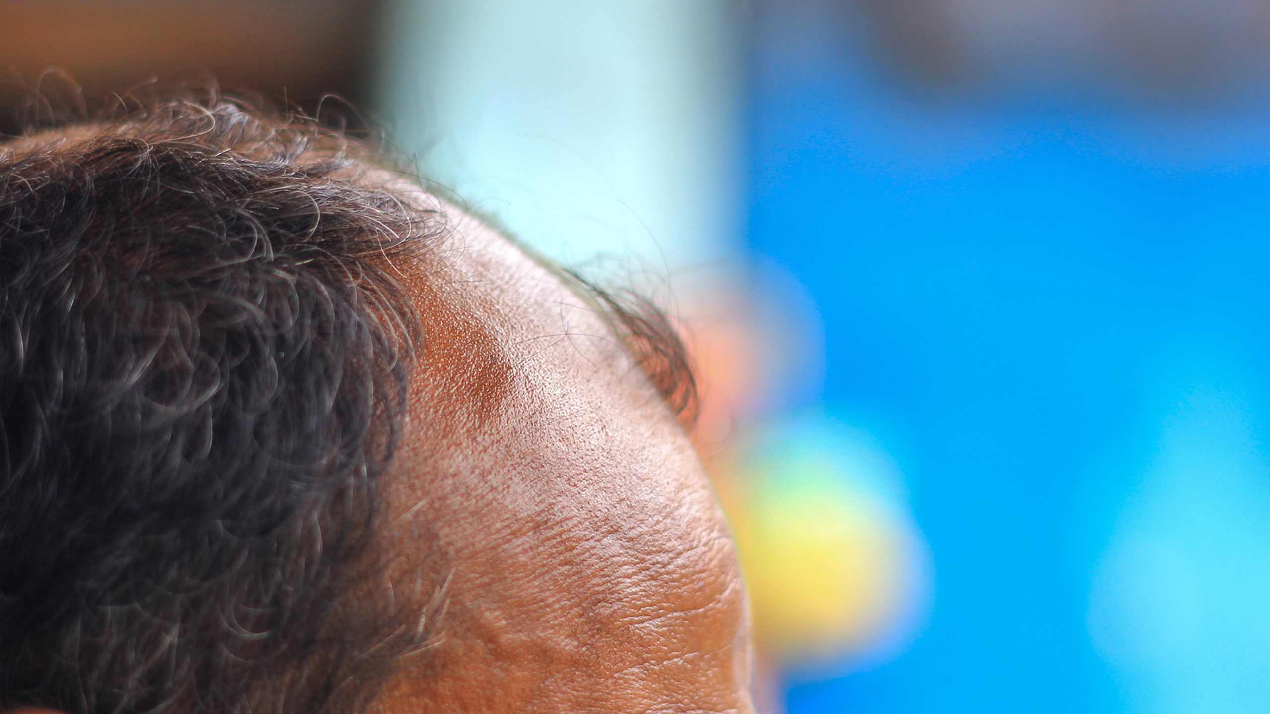 Where to check: Scalp
