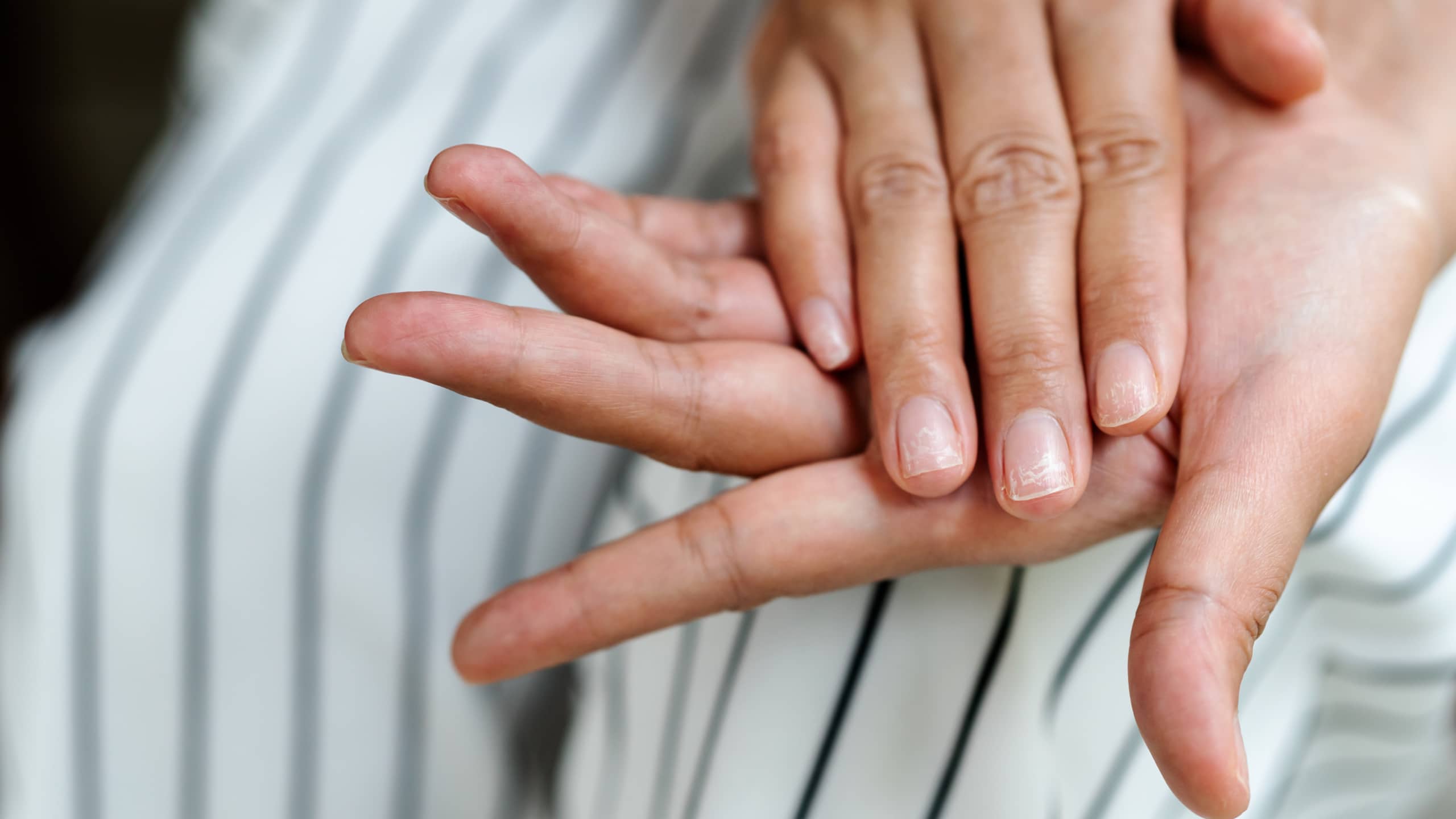 Where to check: Hands, feet and nails