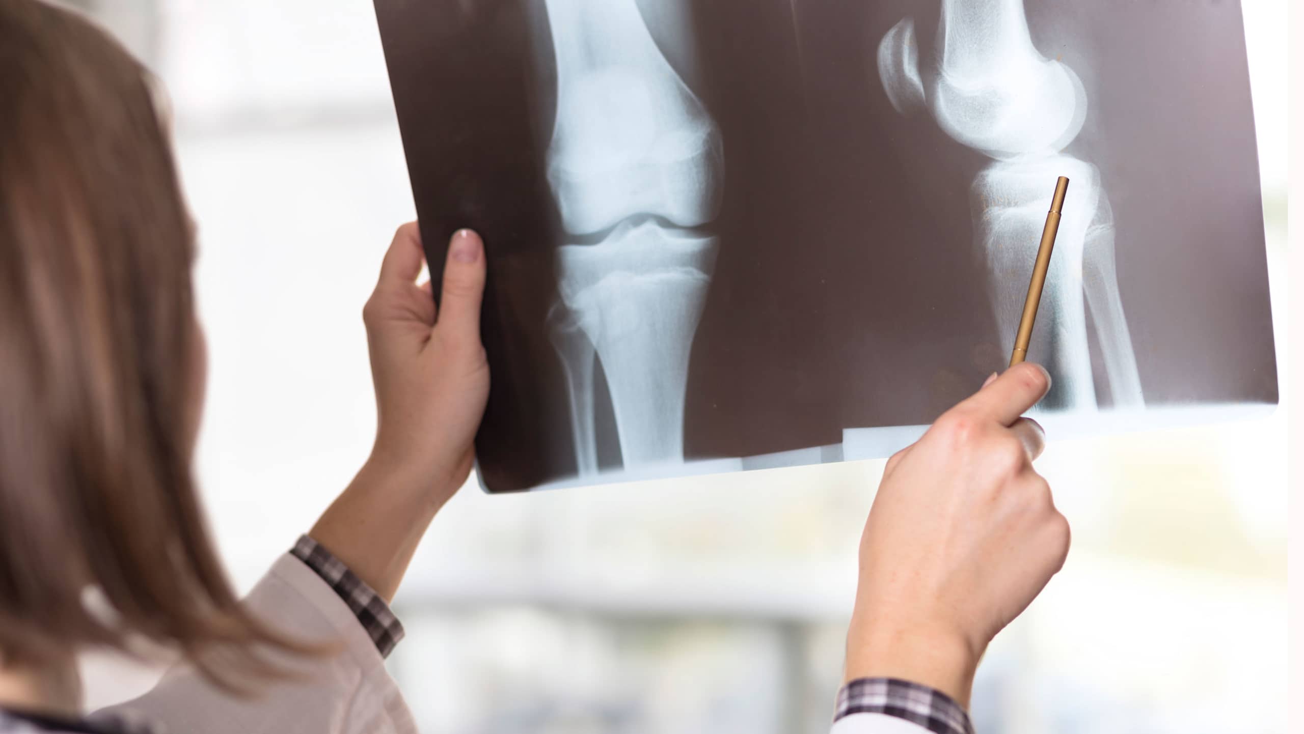 Rheumatoid arthritis tests and exams