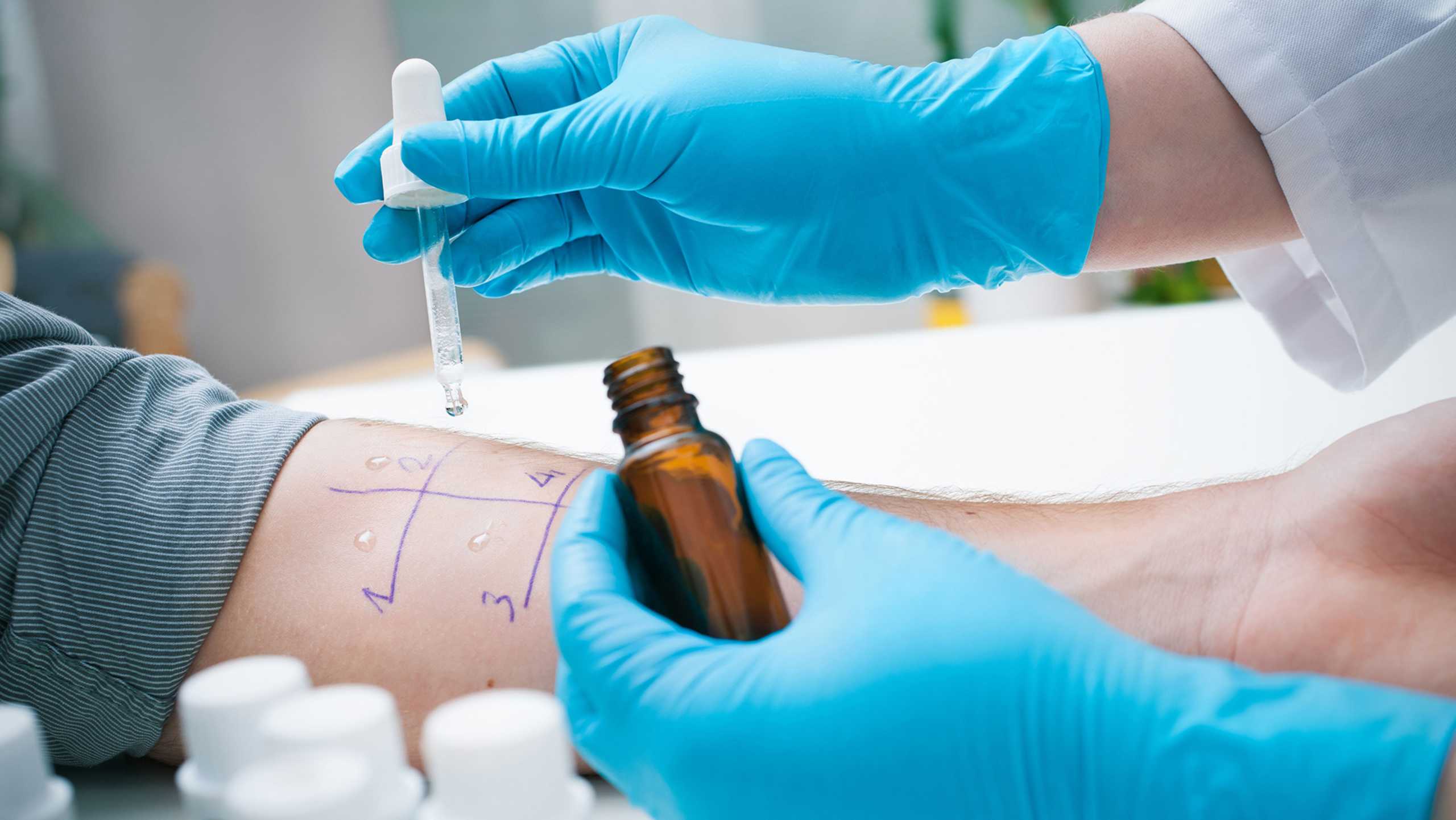 The link between atopic dermatitis and food allergies