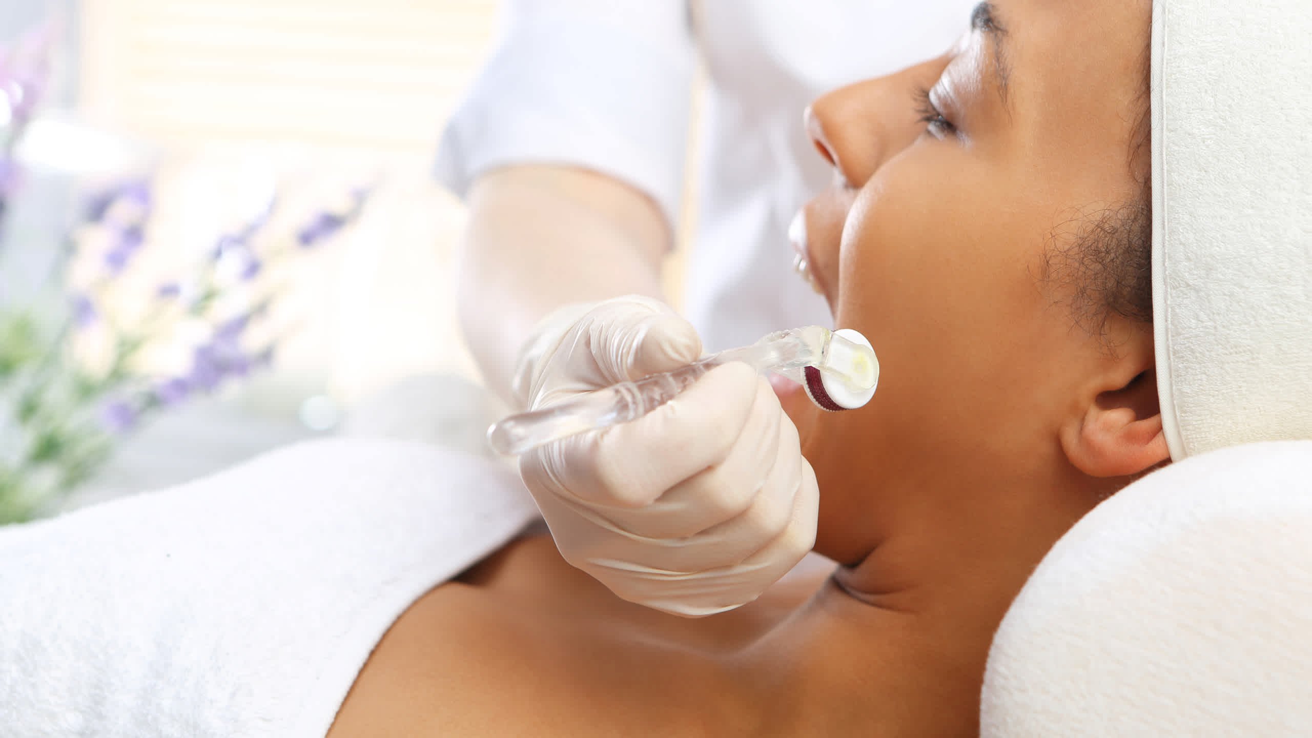 Microneedling