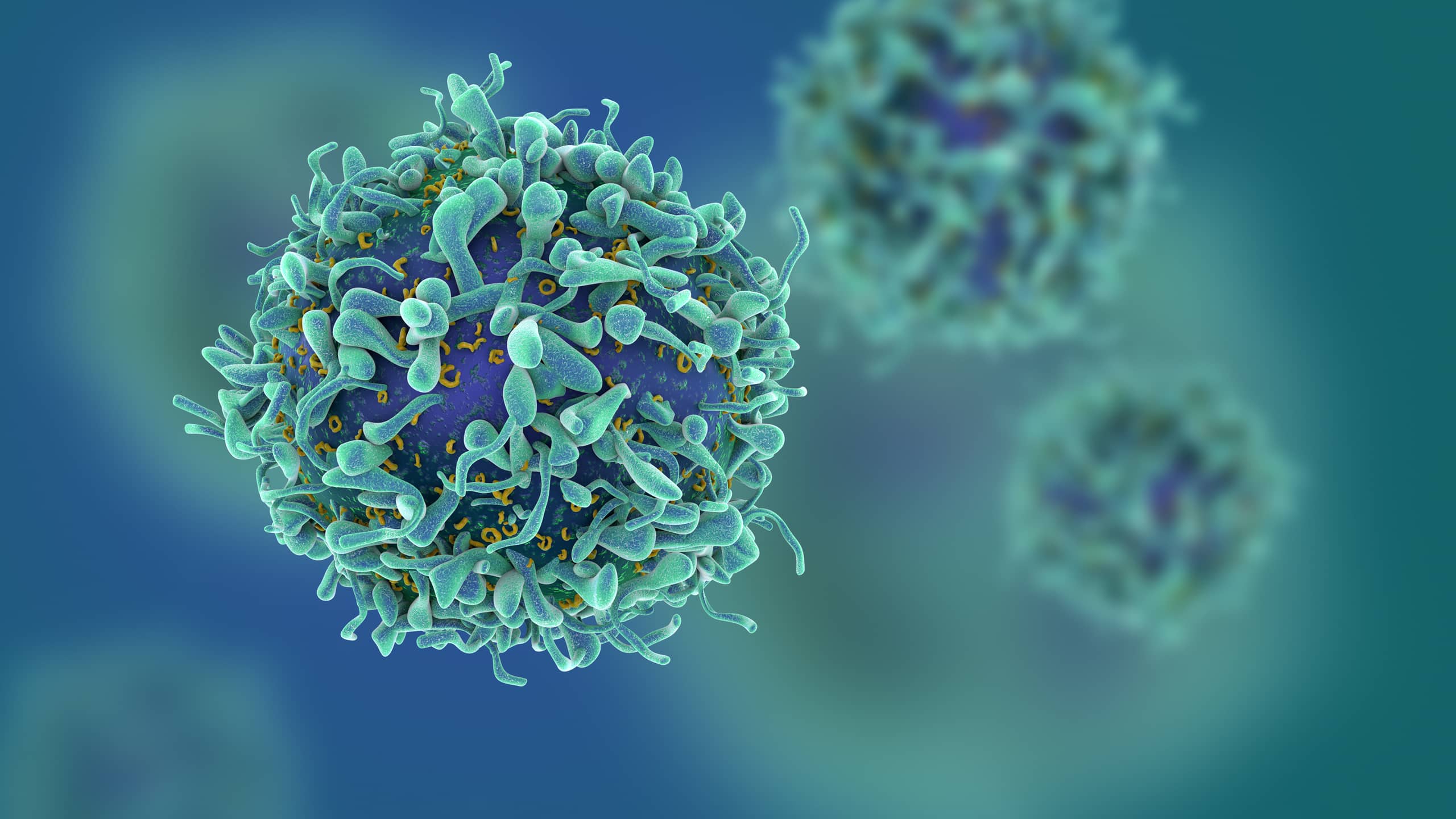 Colorectal cancer is common