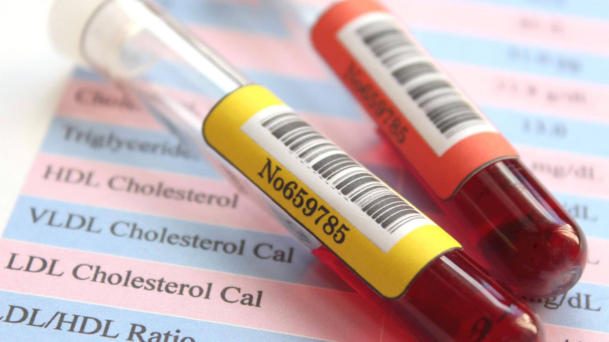 High-density lipoprotein (LDL) levels