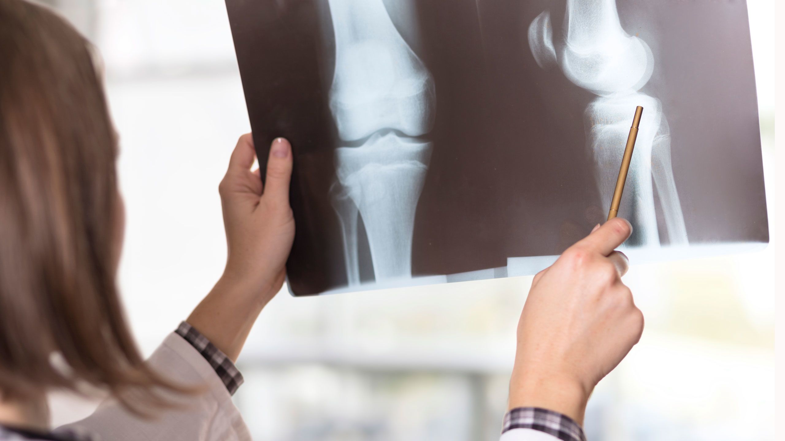 Rheumatoid arthritis tests and exams