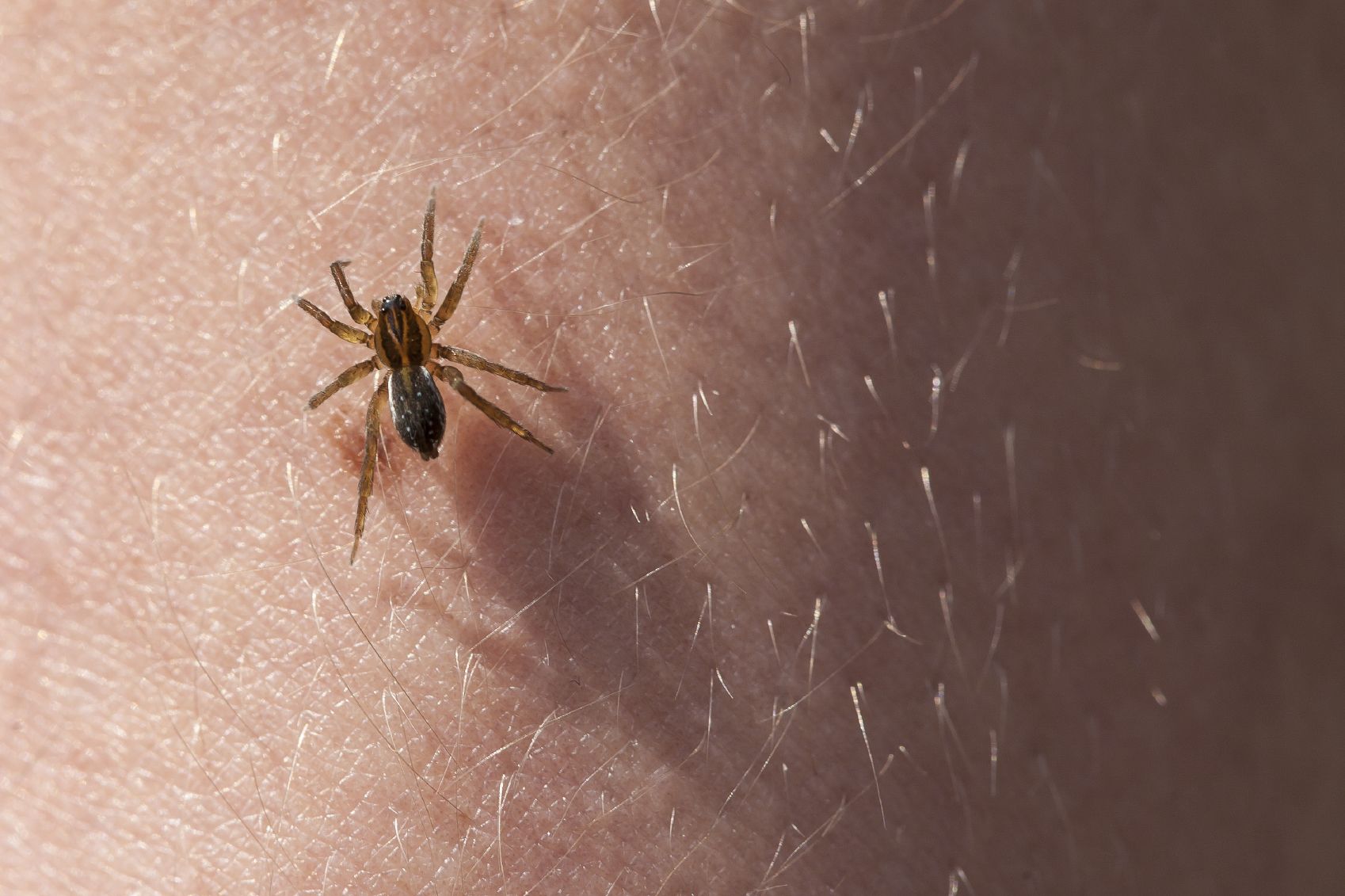 What to Do If You Have a Spider Bite - Sharecare