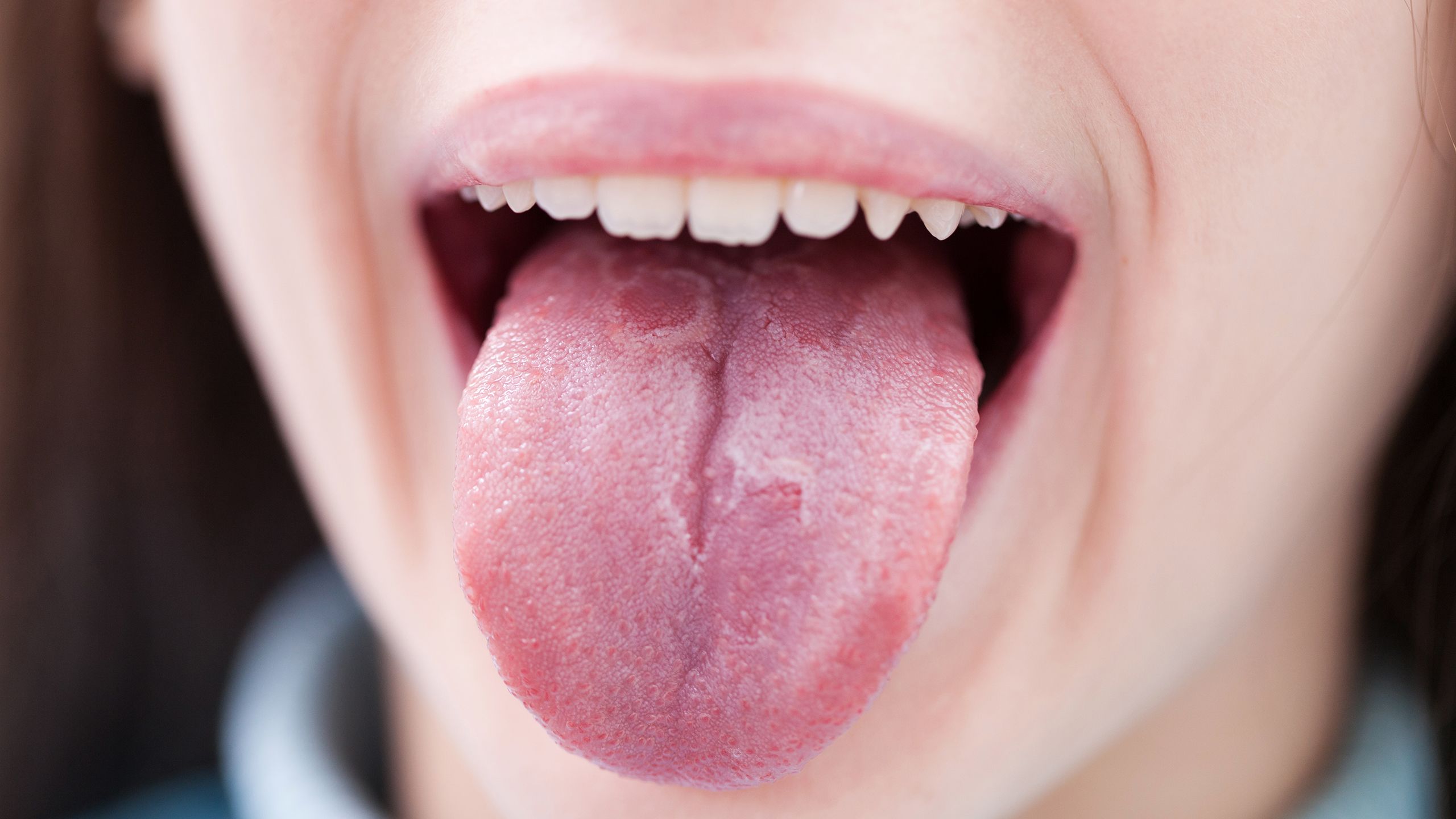 Oral Health Tongue 106