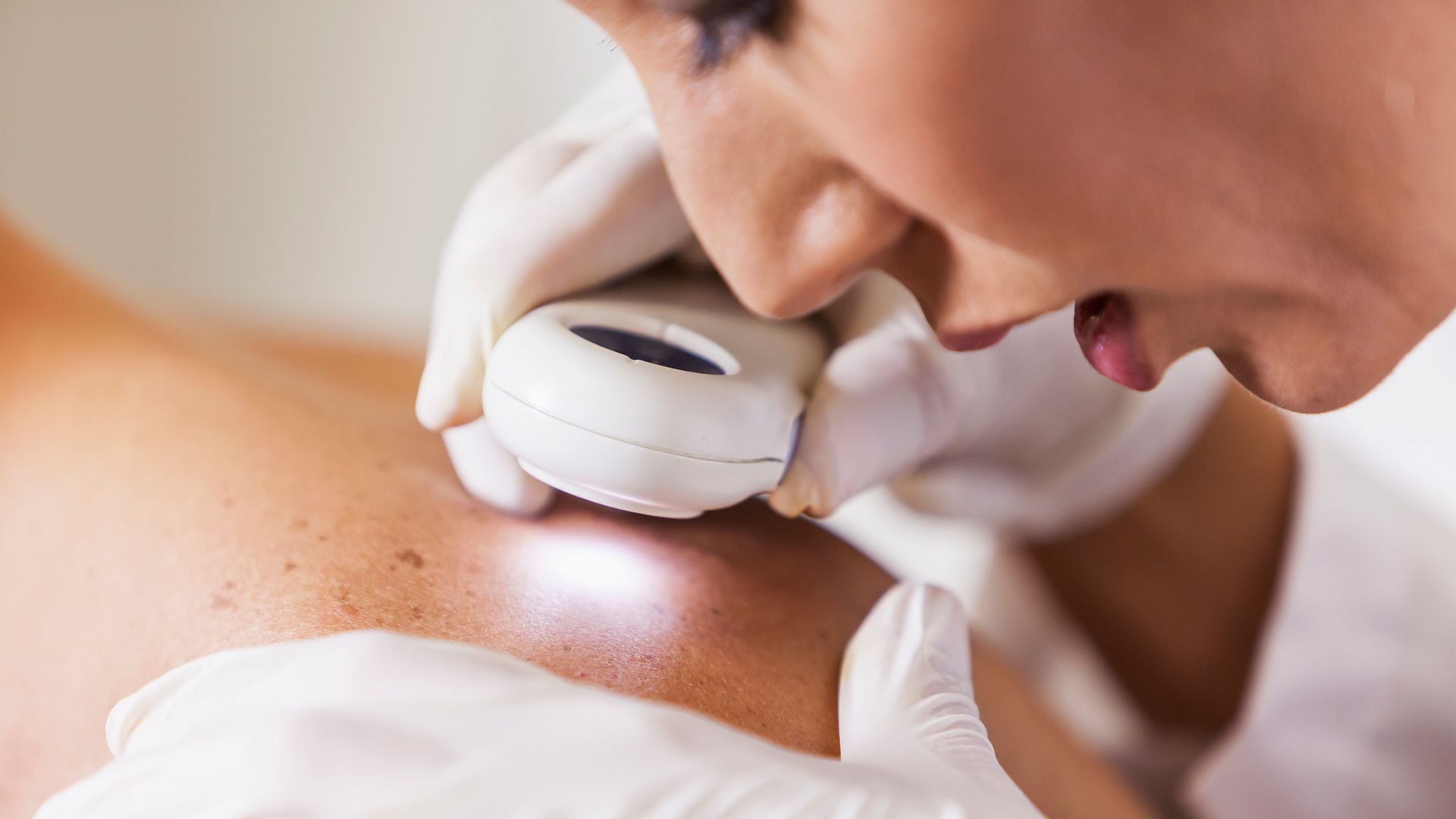 What to know about skin cancer
