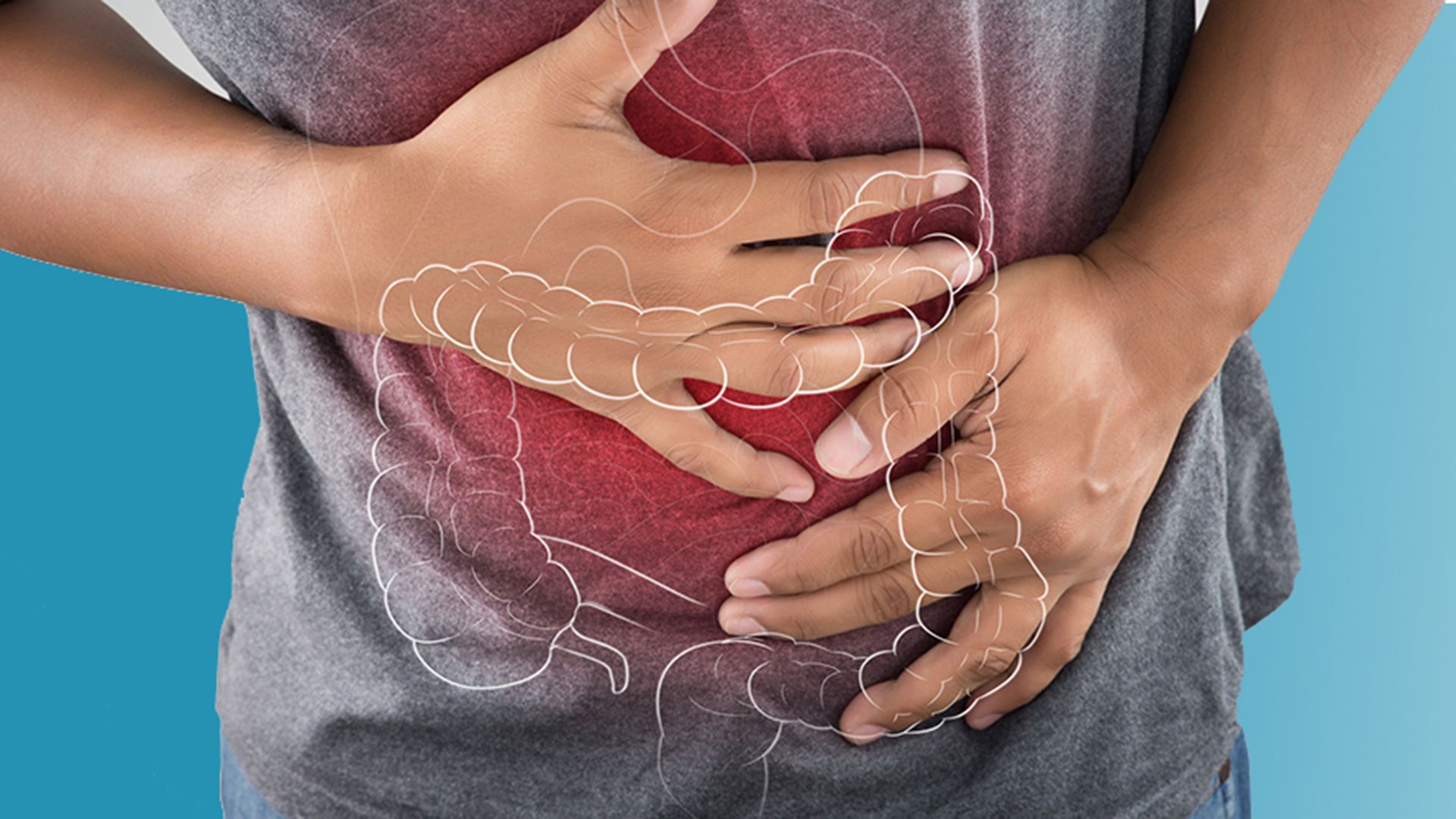 Understanding And Treating Crohn s Disease