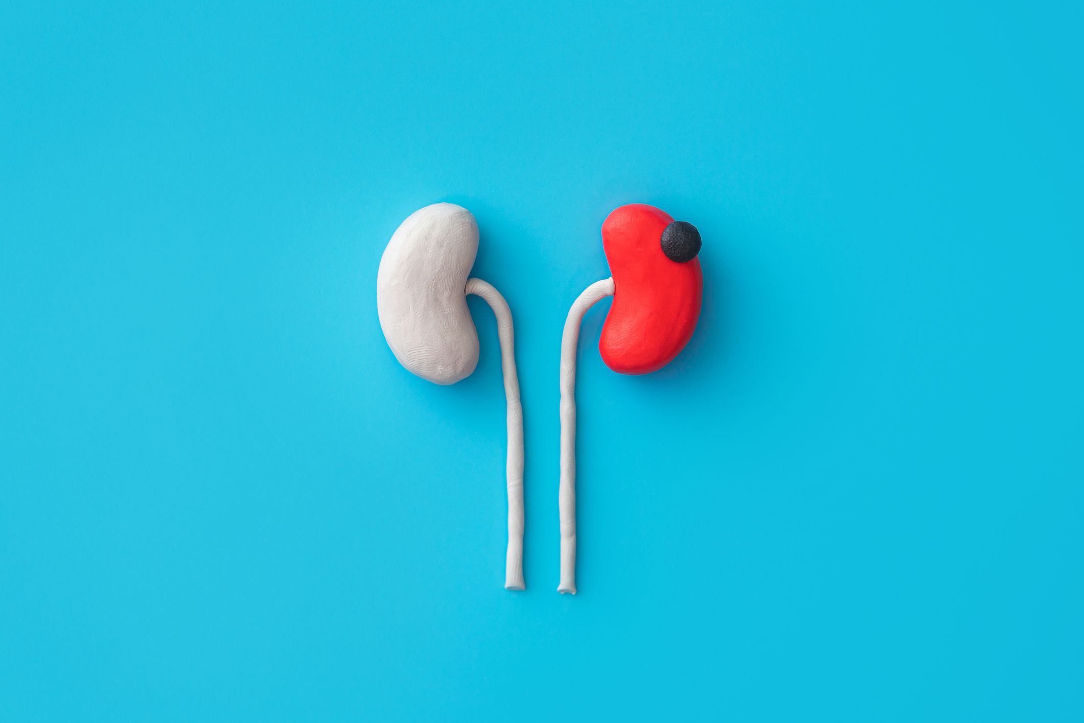 What is the treatment for early-stage kidney cancer?