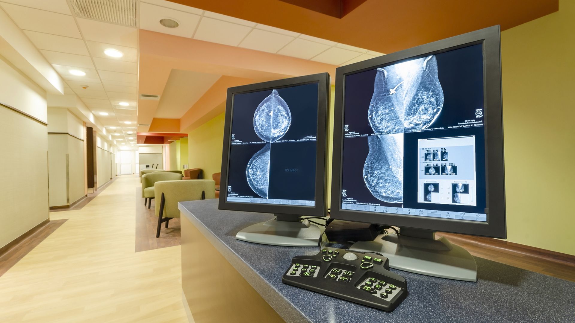 What is Triple-Negative Breast Cancer?