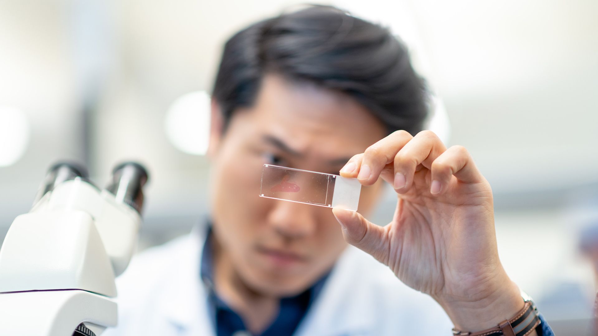 Esophageal cancer: what are biomarkers and immunotherapy?