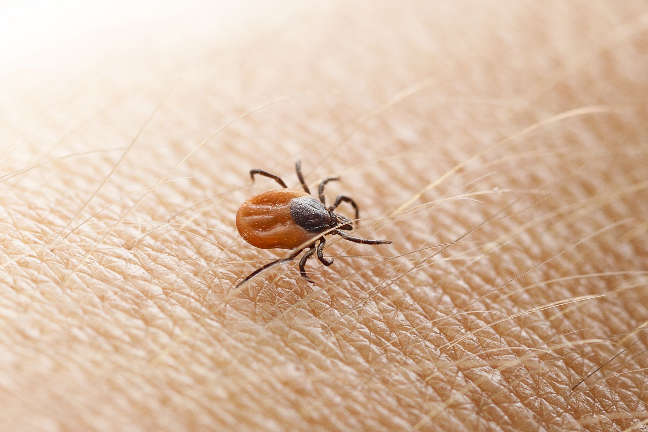 tick bite lyme disease