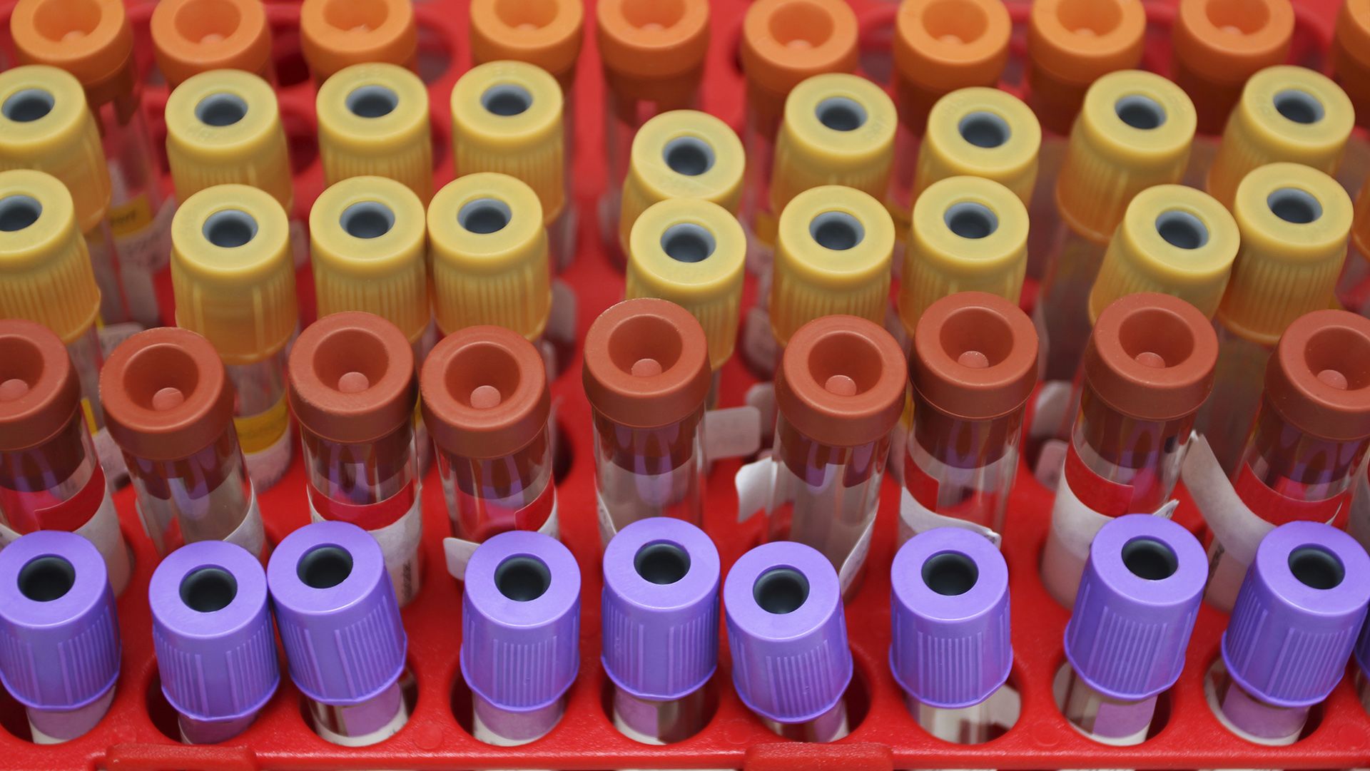 Biomarker testing for non-small cell lung cancer