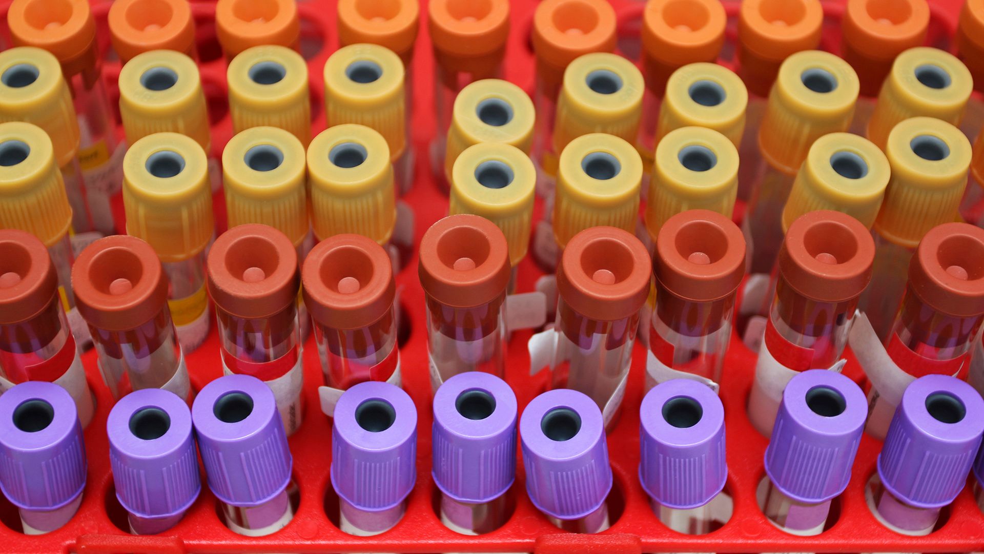 Biomarker testing for non-small cell lung cancer