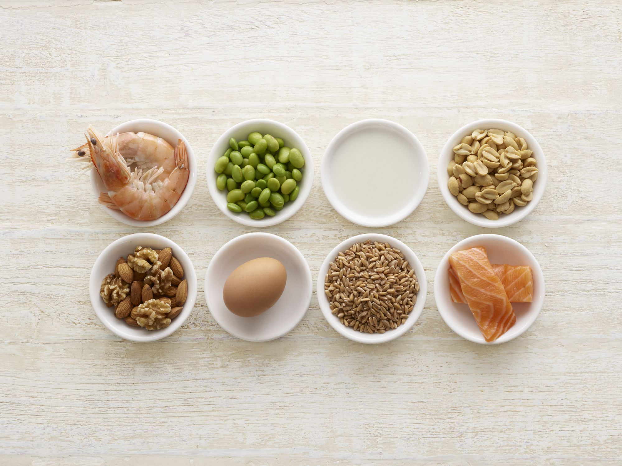 5 Answers About Food Allergies