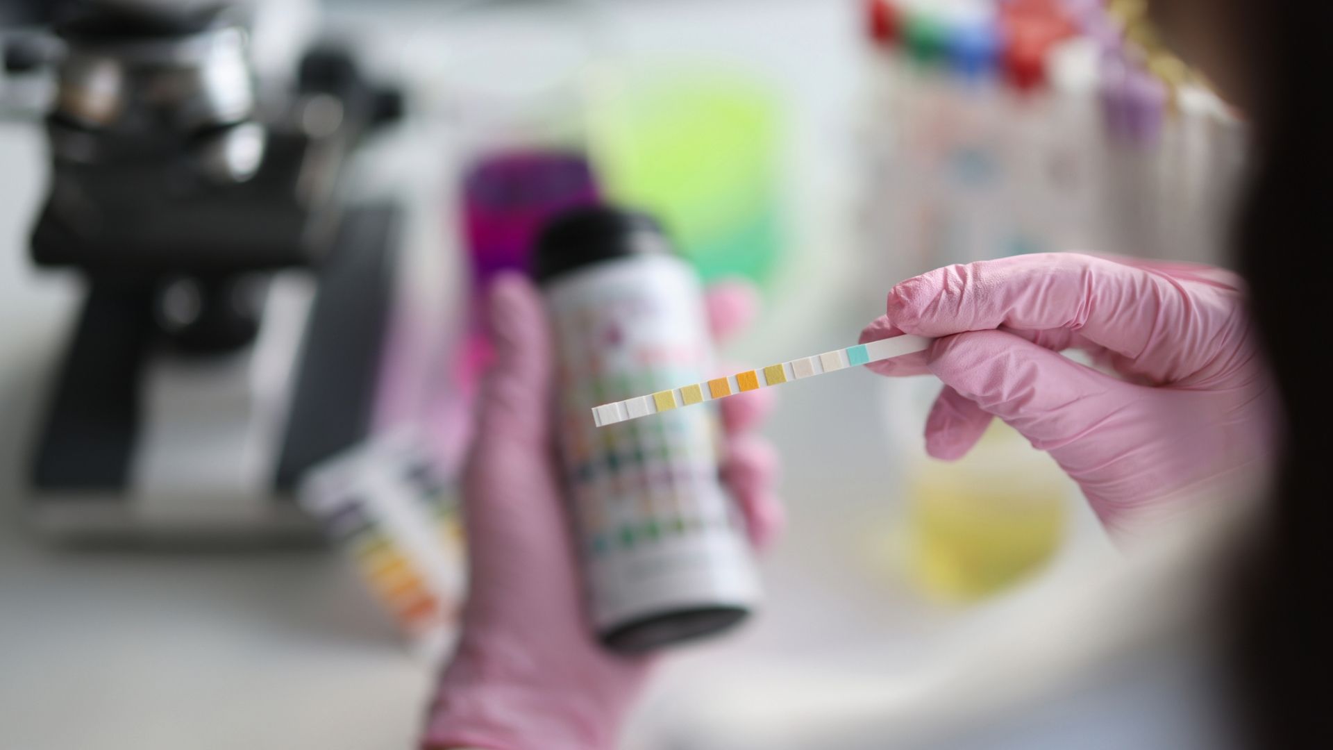 IgA nephropathy: understanding proteinuria