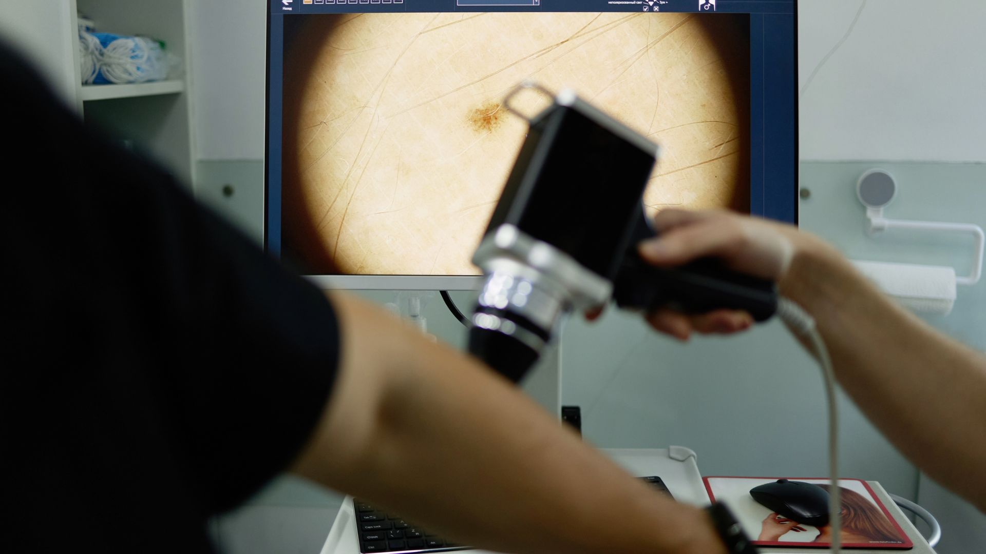 Treating melanoma with subcutaneous immunotherapy