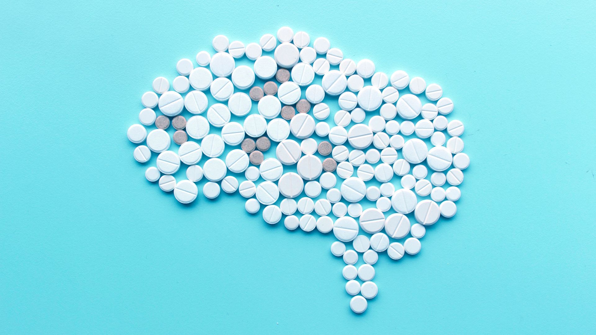 Why a migraine is more than a bad headache