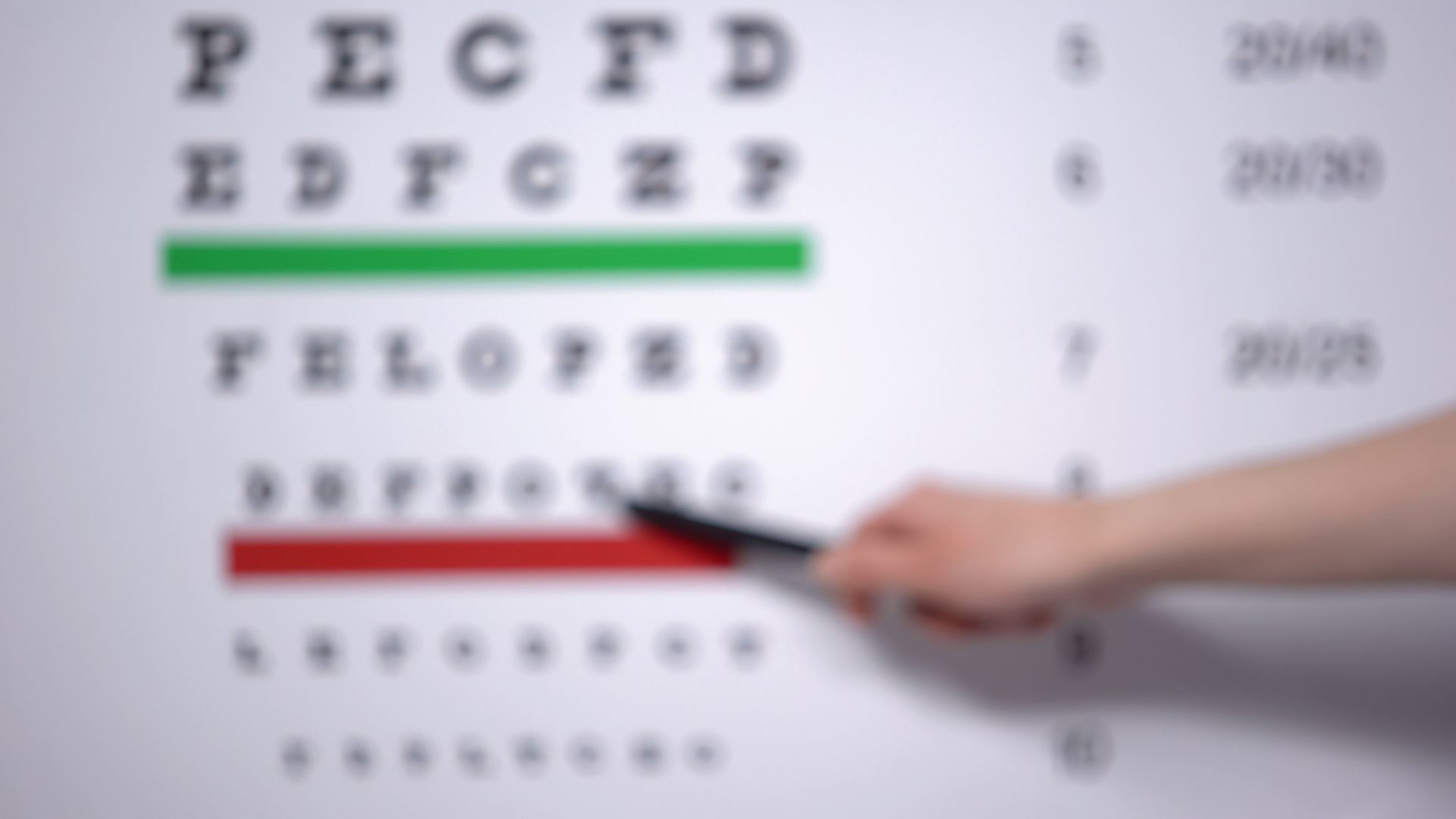 Diabetic macular edema: causes and symptoms