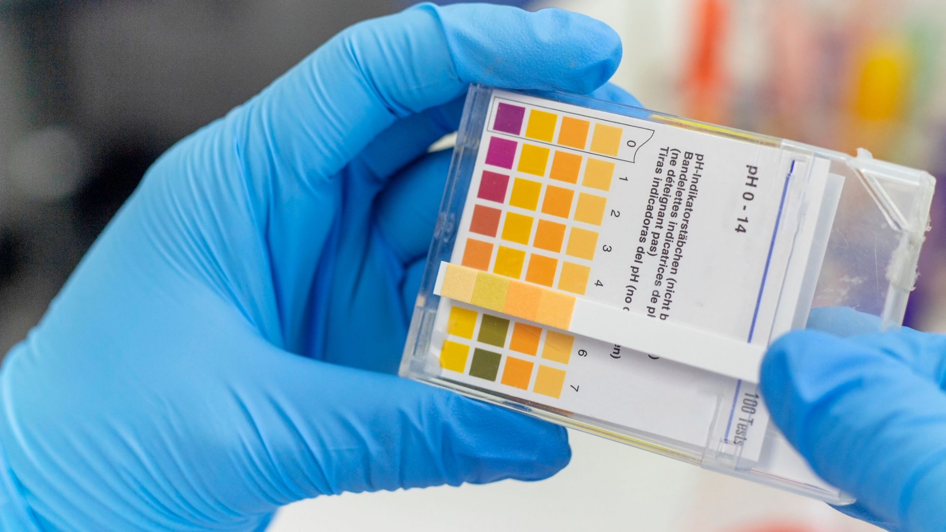 Understanding proteinuria in FSGS