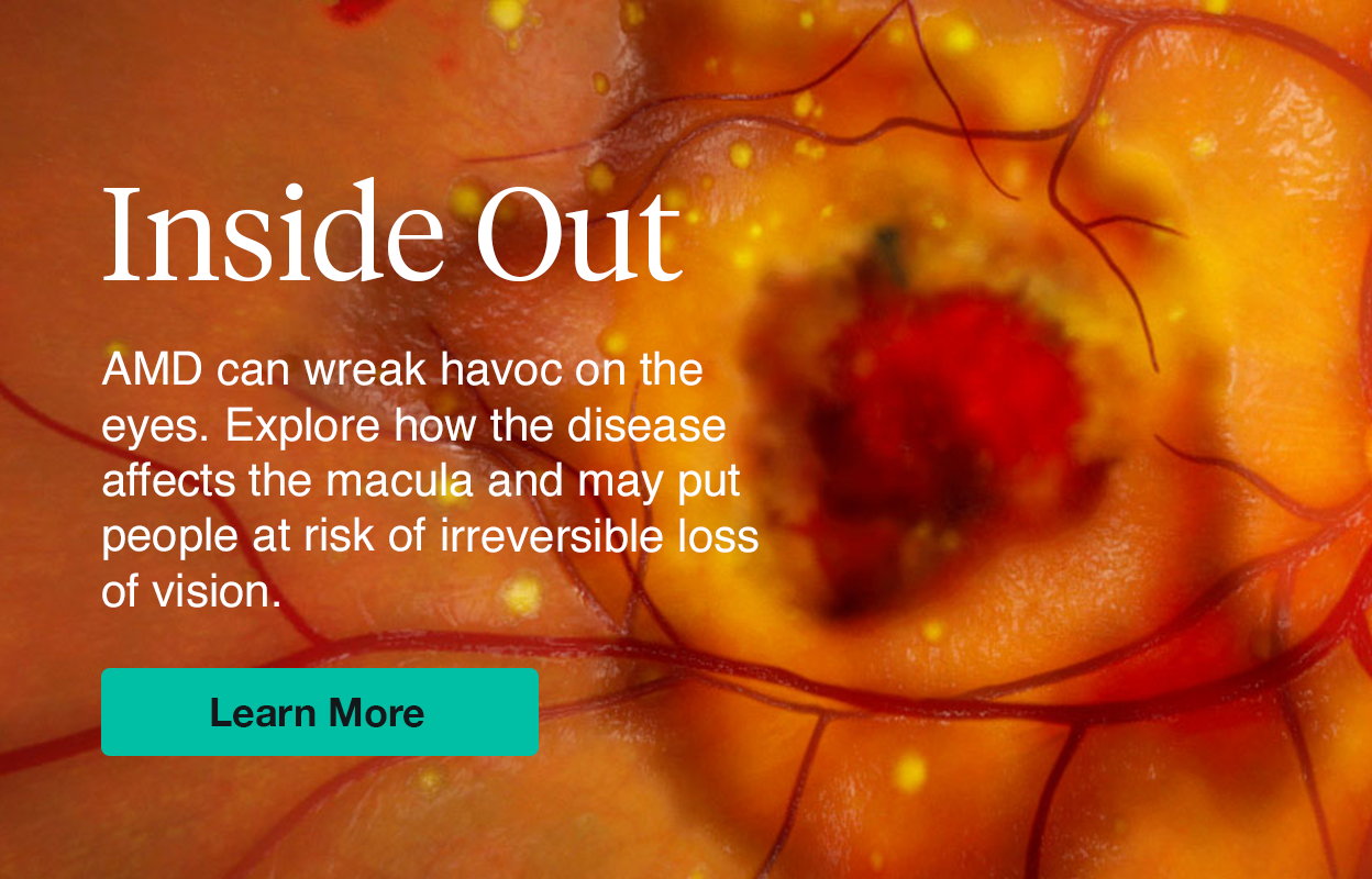 Inside Out: Wet AMD