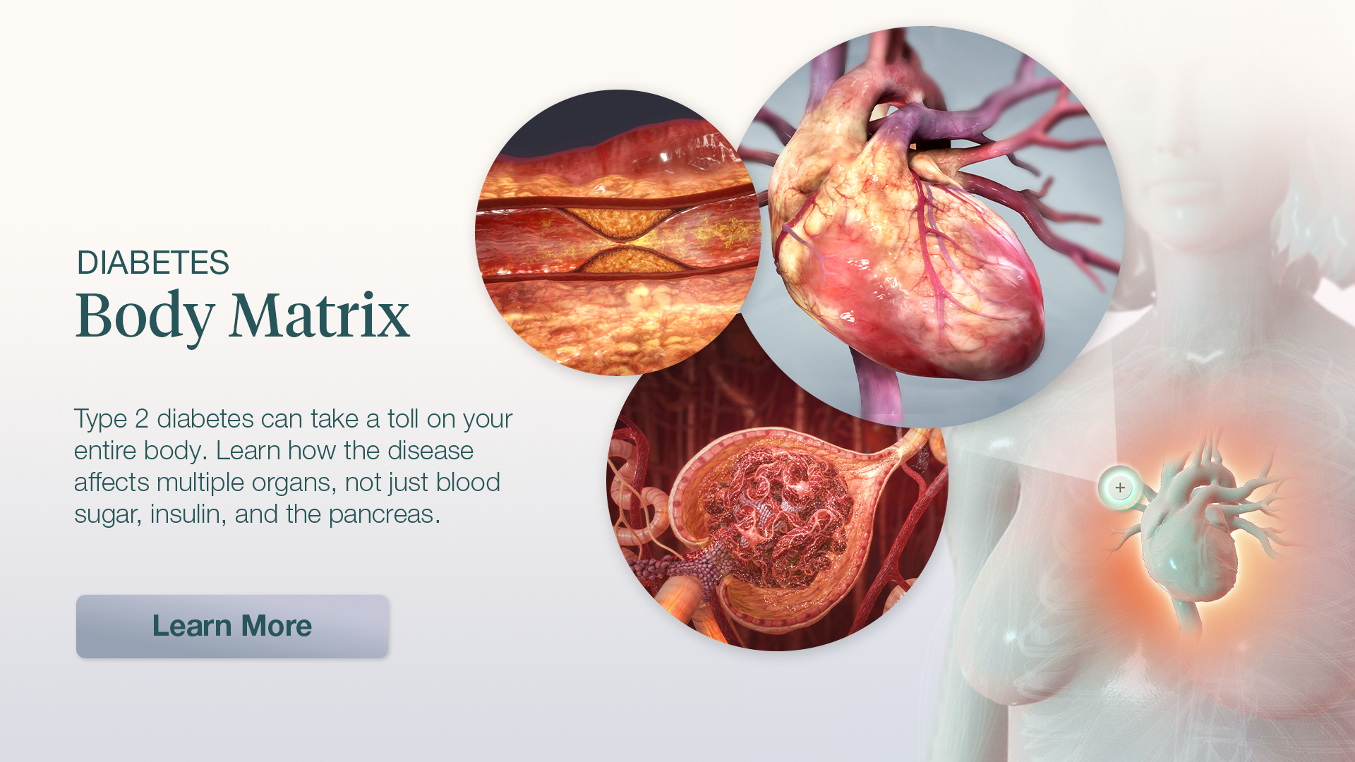 Condition Body Matrix: Diabetes