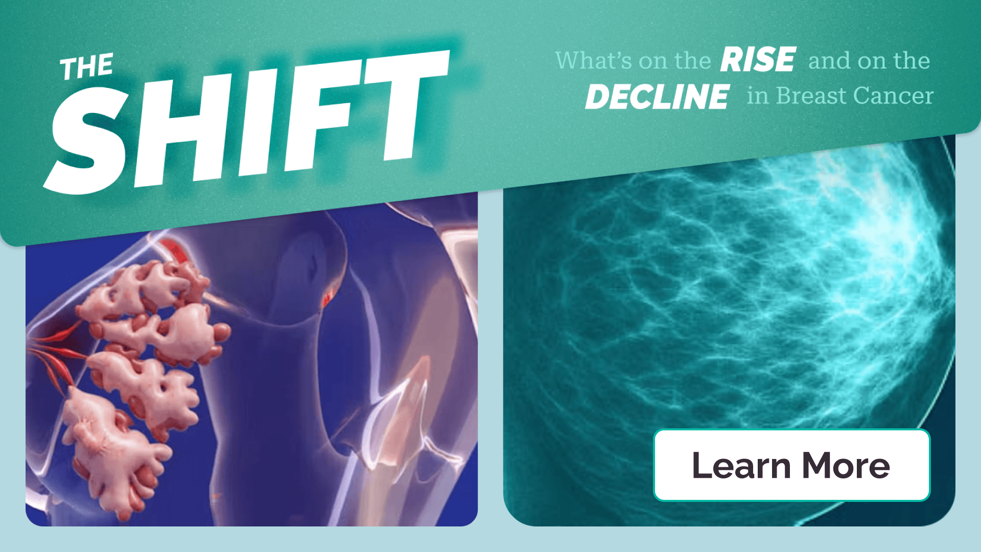 The Shift: Breast Cancer