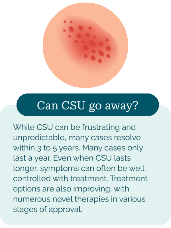 Can CSU Go Away?