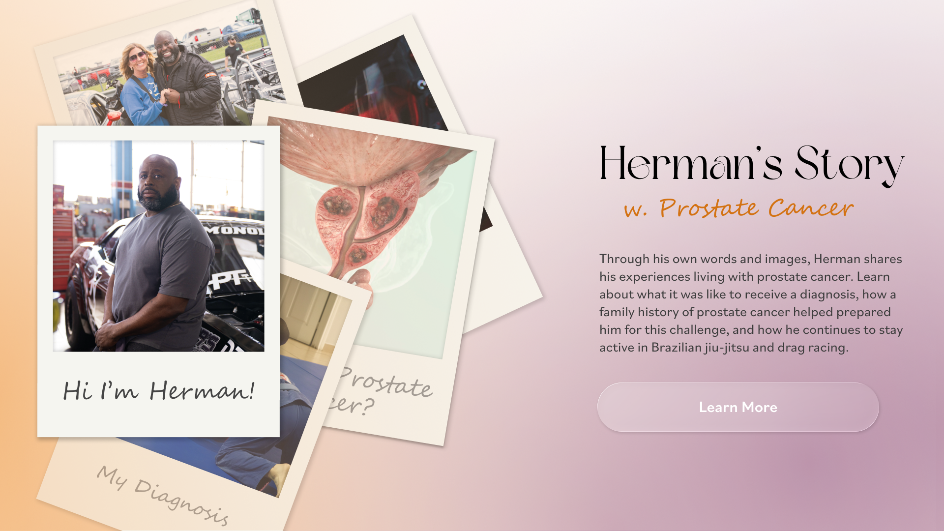 Interactive Patient Journey - Prostate Cancer