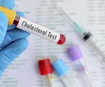 6 Cholesterol Mistakes You're Probably Making