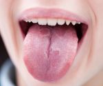 What your tongue reveals about your health