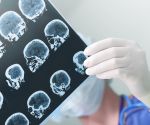 4 health risks linked to depression