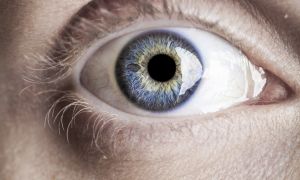 Looking for stroke risks in eyeball photos