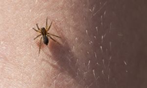 What to Do If You Have a Spider Bite