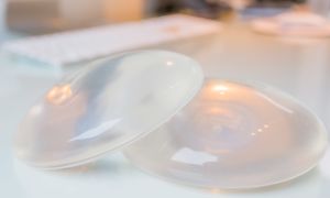 5 common questions about breast implants