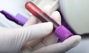 The health complications of hepatitis C