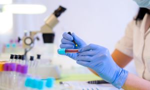 How a Blood Test May Help Rheumatoid Arthritis Patients