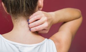 Why atopic dermatitis is more than just dry skin