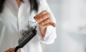 Is your hair falling out? Female-pattern hair loss may be the cause