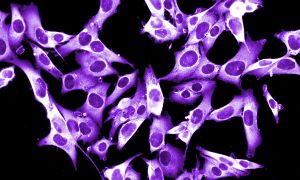 What to know about skin cancer