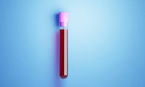 A guide to understanding your iron levels