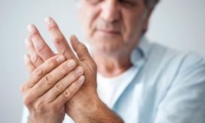 5 frequently asked questions about rheumatoid arthritis flares