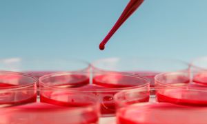 Learn the risk factors of anemia