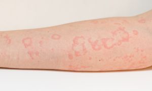 What do you need from your CSU treatment plan?