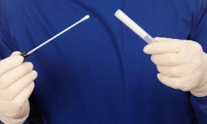 What does it mean if my Pap test is abnormal?