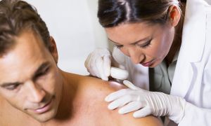 What to know about symptoms of skin cancer