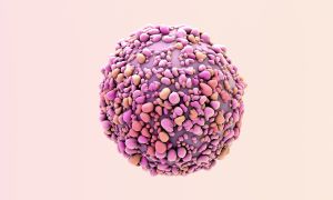 Metastatic Breast Cancer: Understanding Targeted Therapy